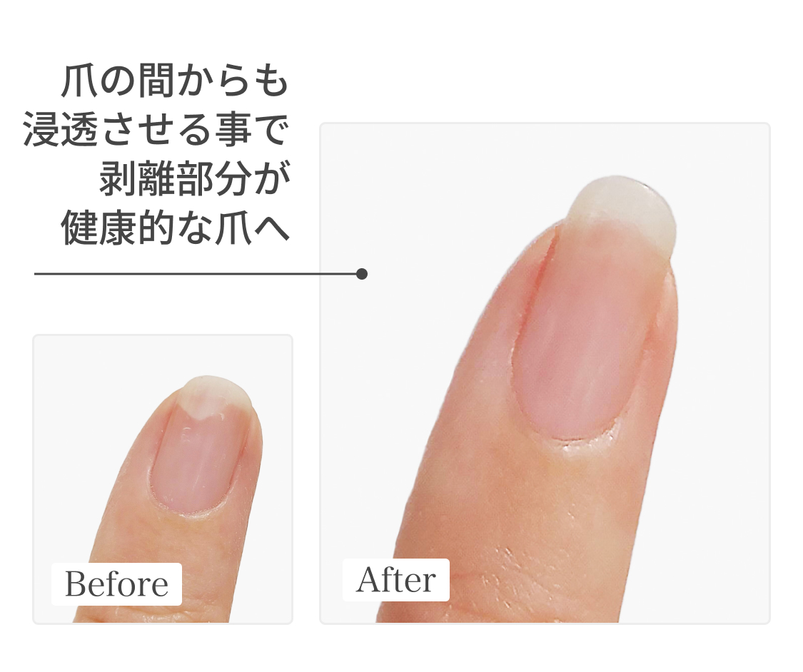 uka better nail serum | 【公式】オンラインストアukakau
