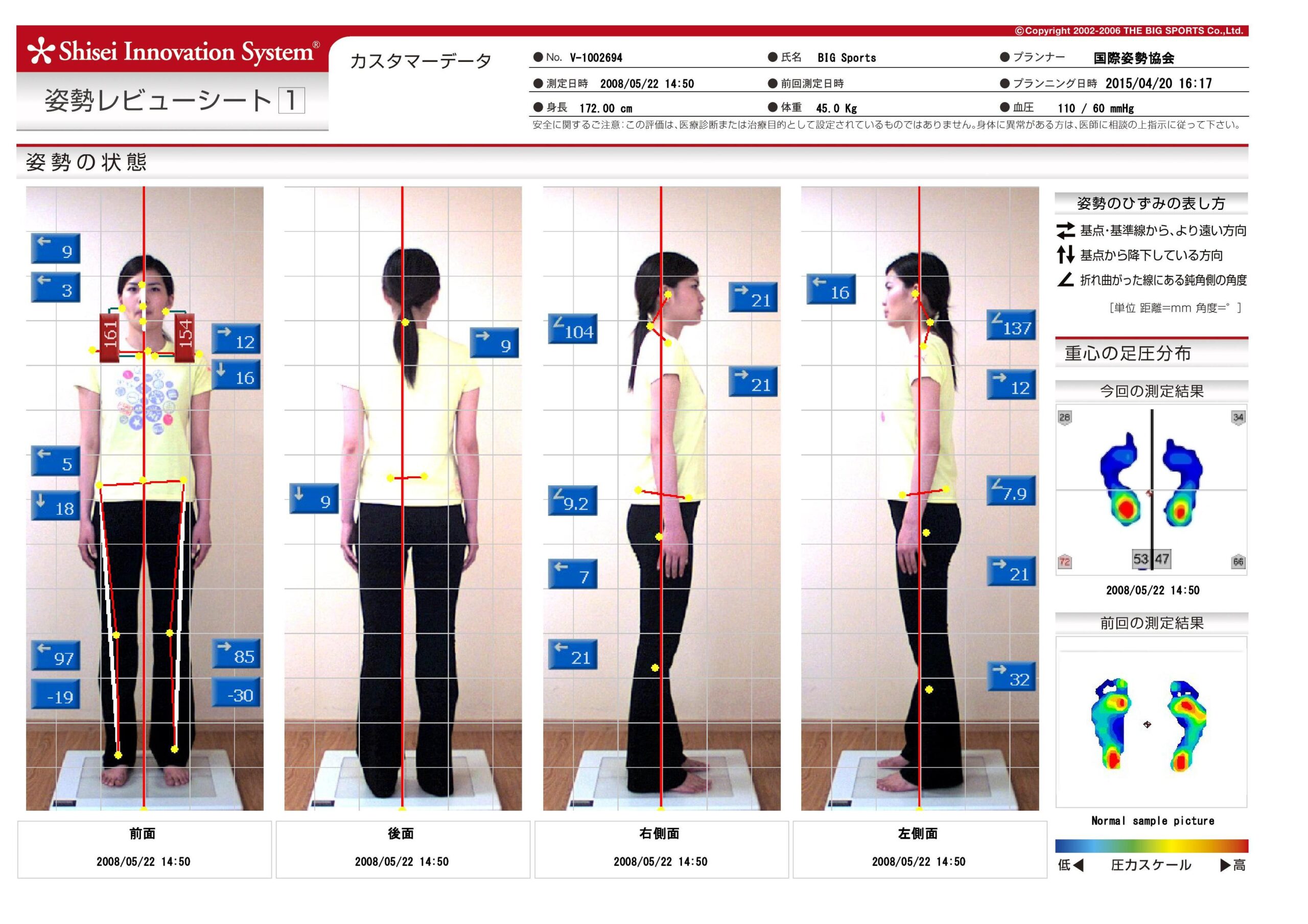姿勢評価システムを導入しました。 – わしざわ整形外科 新着ニュース