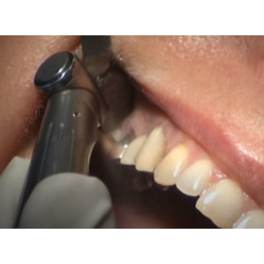 商品情報｜医療従事者向けページ｜歯科器材のクロスフィールド