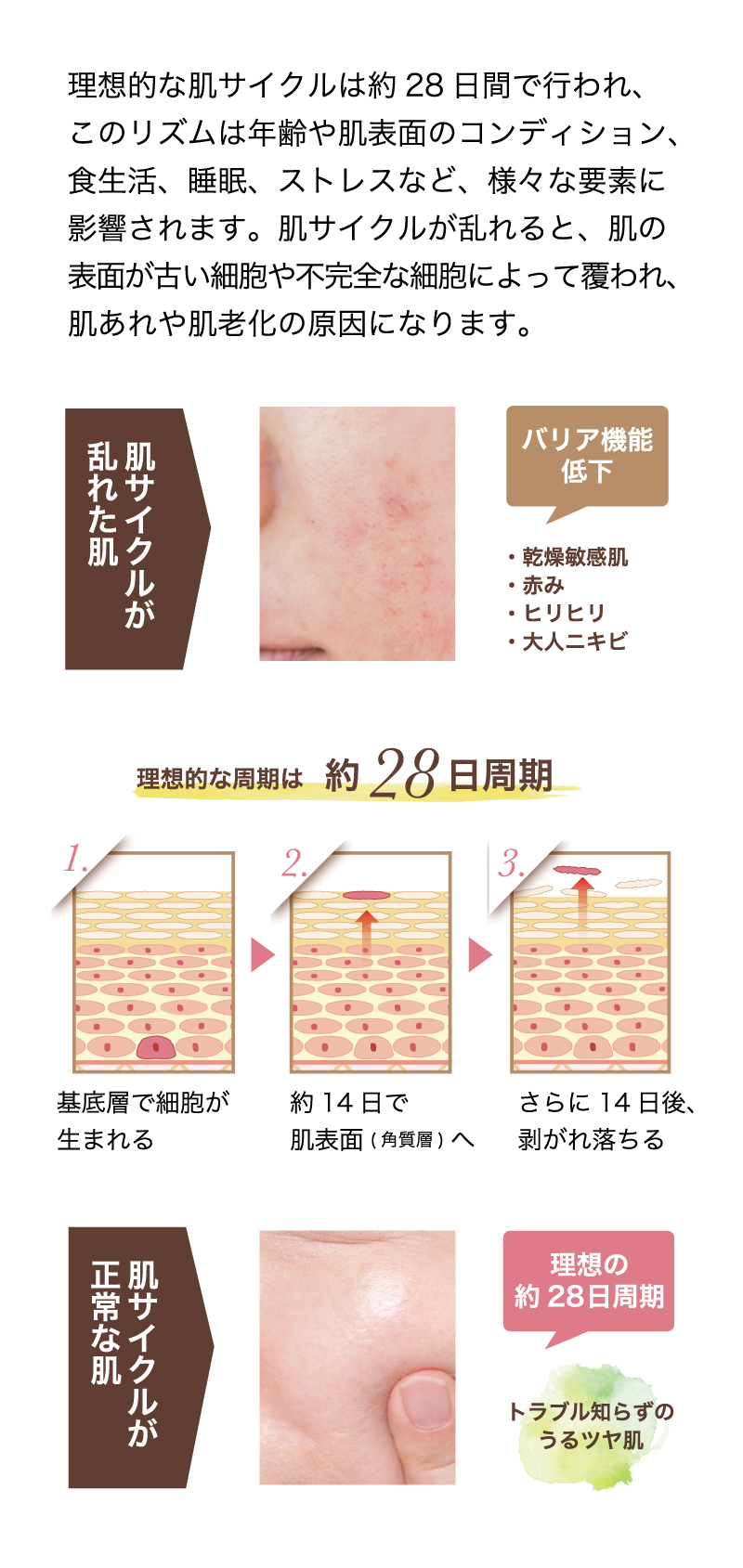 ルナゾーム レチムローション - EBM