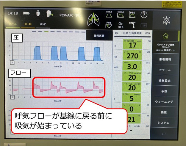 IMI WEBセミナー 「明日から使える人工呼吸器管理の基本 ～呼吸器疾患