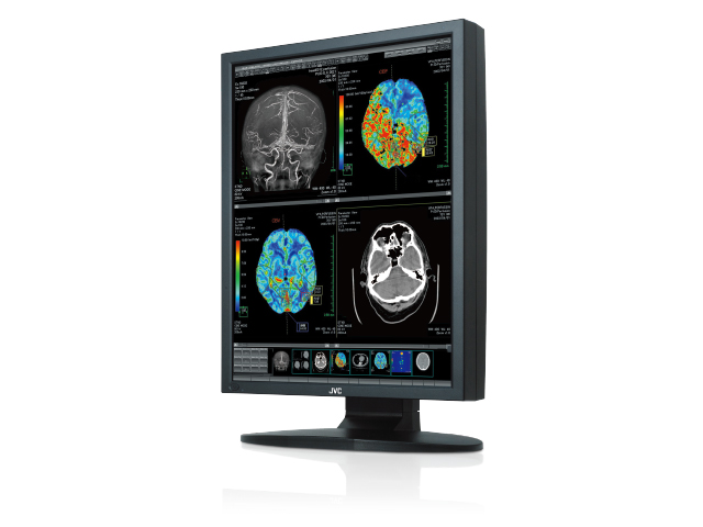200万画素21.3型カラー液晶モニターCCL258i2 | 医用モニター / 産業用
