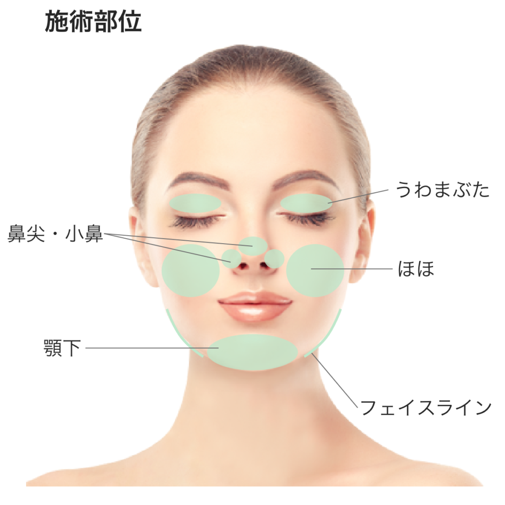 KSKINNY PCL ケイスキニー ボディアンプル 脂肪溶解 50ml KSKINNY