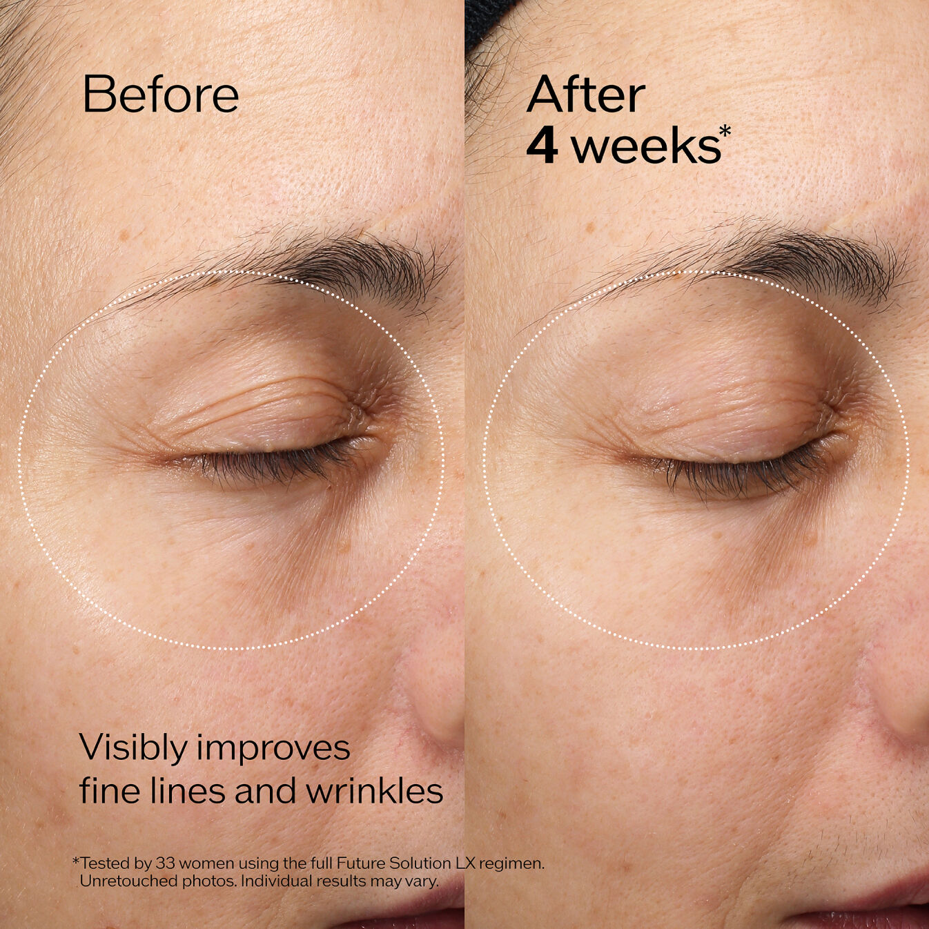 Future Solution LX Lip and Eye Contour Cream | SHISEIDO