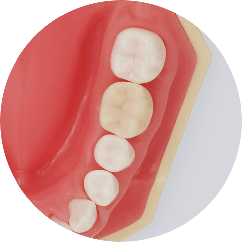 EVK450｜Surgitel～拡大鏡サージテル～歯科専用サイト