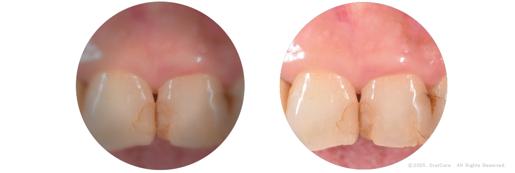 EVK450｜Surgitel～拡大鏡サージテル～歯科専用サイト