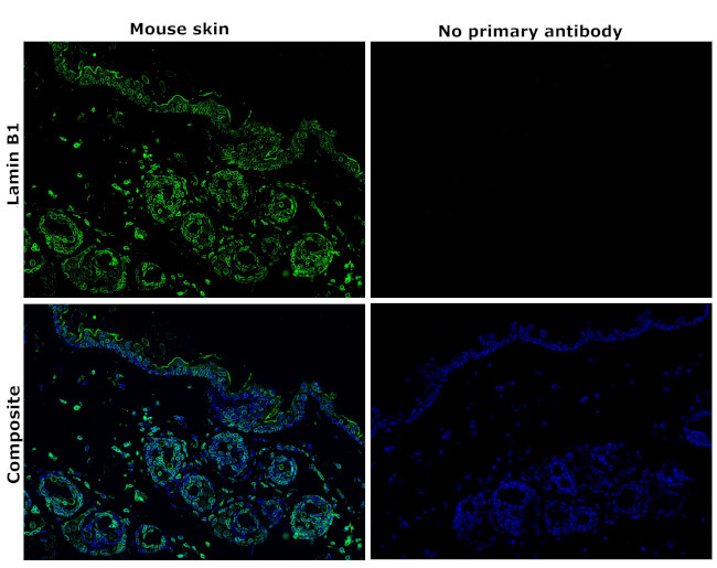 Lamin B1 Recombinant Monoclonal Antibody (10H34L18) (702972)