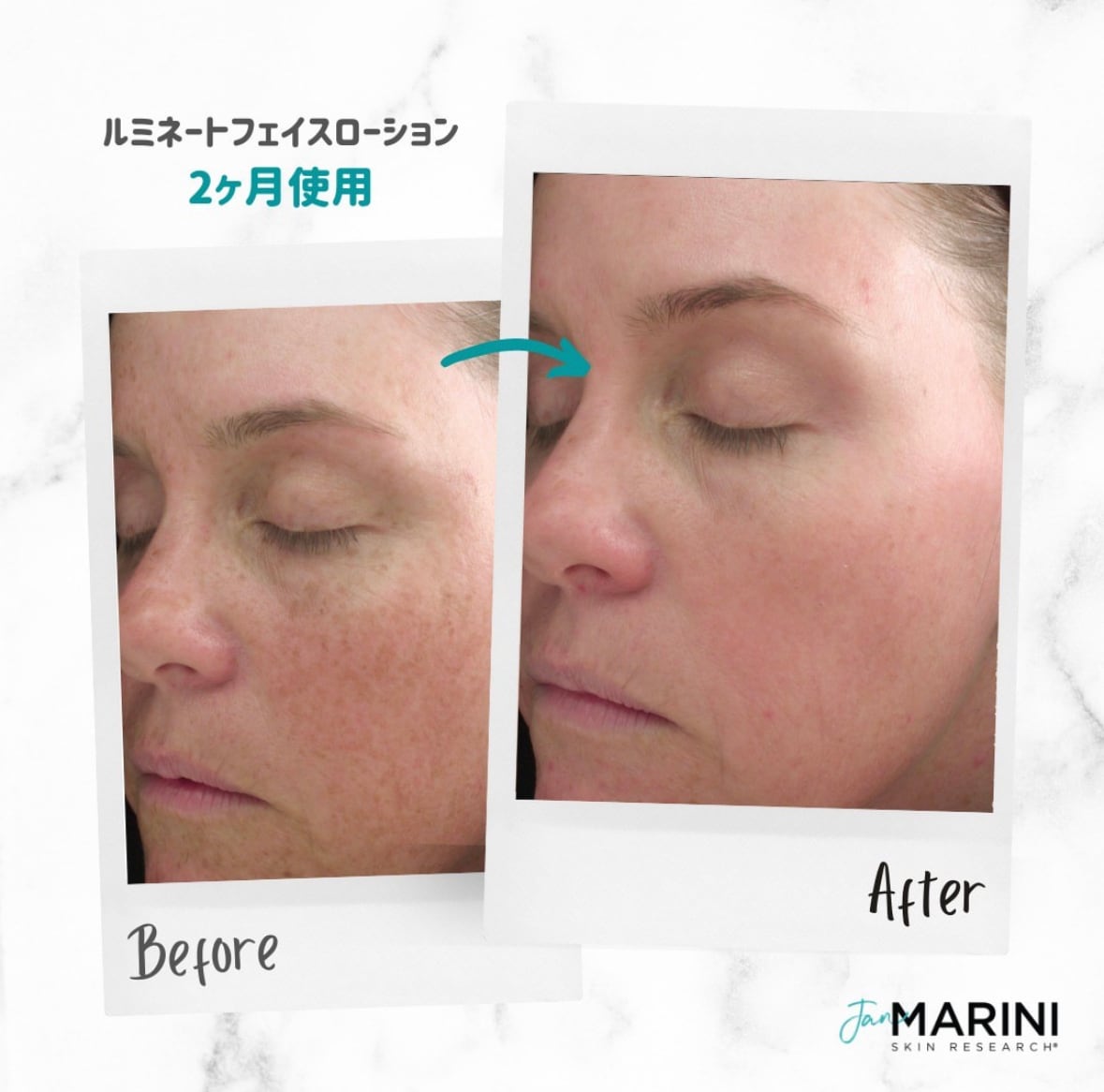 美白】ルミネート フェイスローション（レチノール0.3％＆ノン