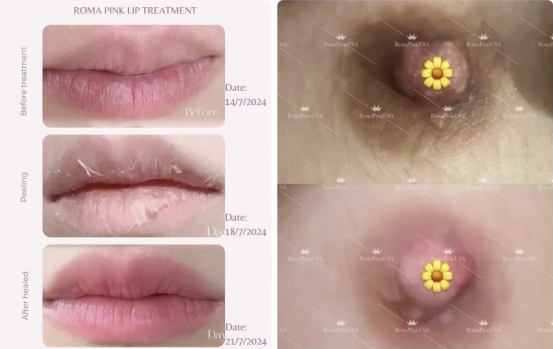 ローマピンクとは？ | Mahana