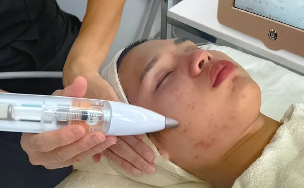 レモンボトル（脂肪溶解美容液） | 業務用美容・エステ機器の卸・仕入