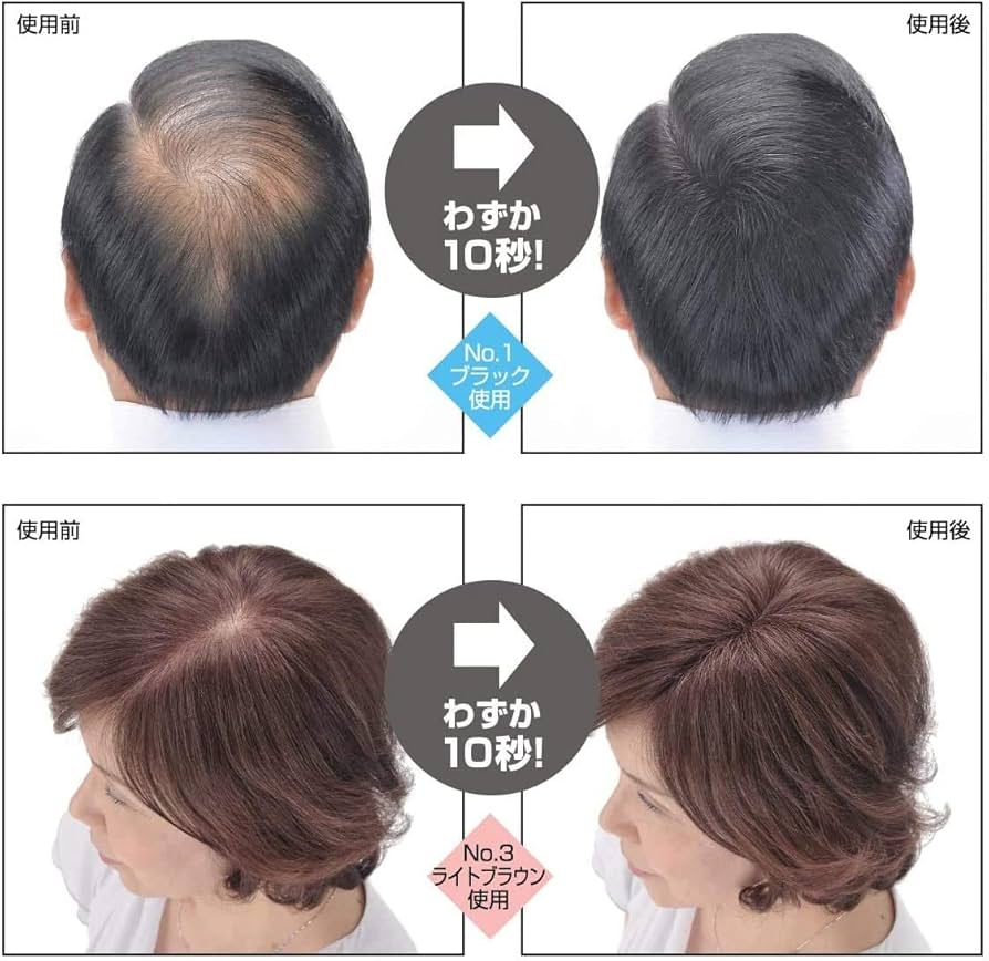 Amazon | スーパーミリオンヘアー 30g ダークブラウン | スーパー