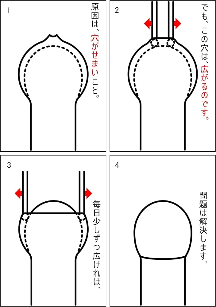 Amazon.co.jp: Kito-kun dx (Manufacturer Direct Sales) Exclusively
