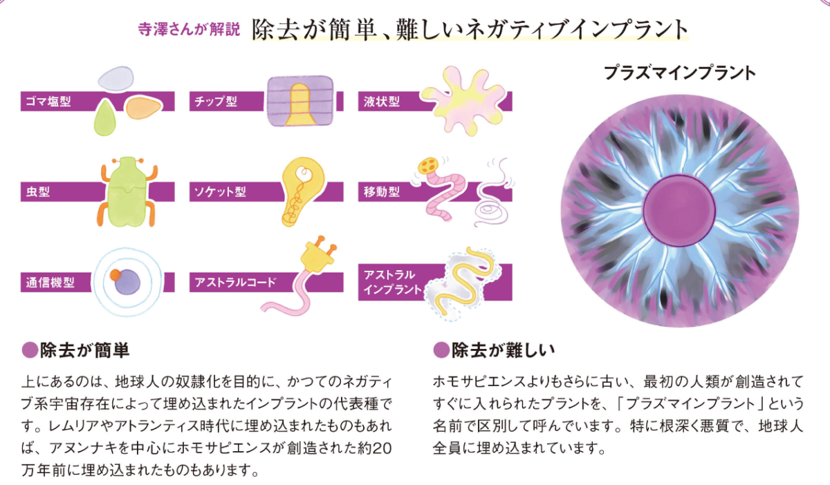 首の後ろからプラズマインプラントを外す】ネックインプラント除去