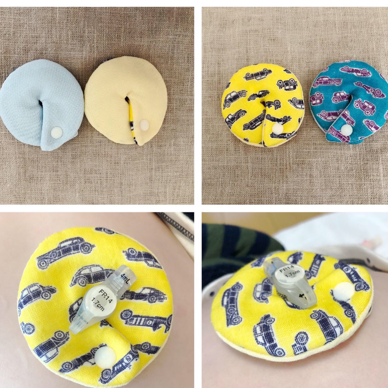 胃ろうカバー☆胃ろうパッド オーダー受付 - ANEMONE18T'S GALLERY